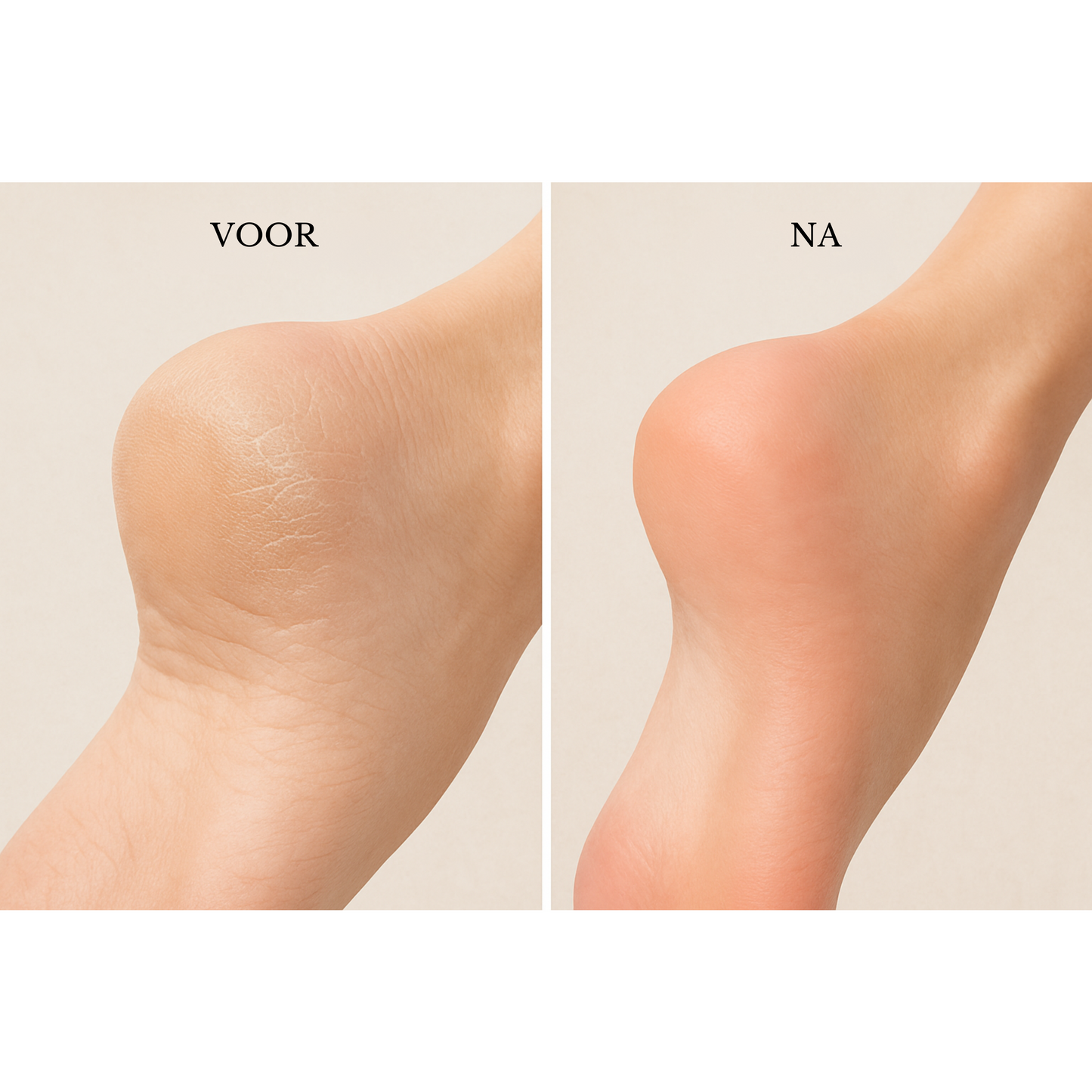 Amira SmoothFeet – Schmerzfreie Hornhautentfernung für geschmeidige, sichere Schritte